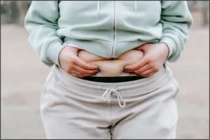 Cirurgia bariátrica: o que é, quem pode fazer e quais são os riscos Cirurgia bariátrica: o que é, quem pode fazer e quais são os riscos