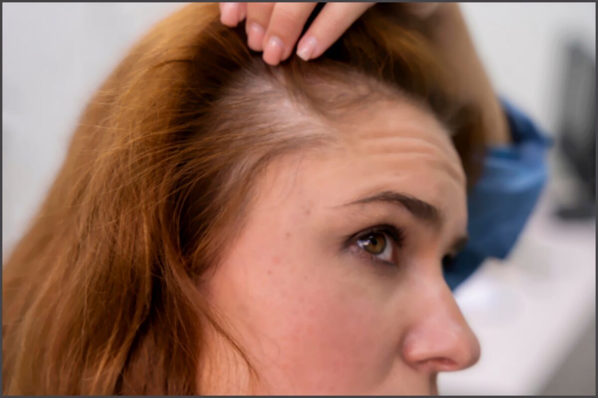 Os 7 Melhores Cortes para Mulheres que Querem Disfarçar a Queda de Cabelo